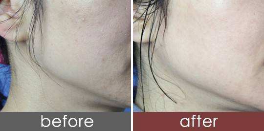 处女脸、果汁脸,你的老公鹿晗林更新们到底心水哪一款?