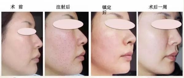 处女脸、果汁脸,你的老公鹿晗林更新们到底心水哪一款?