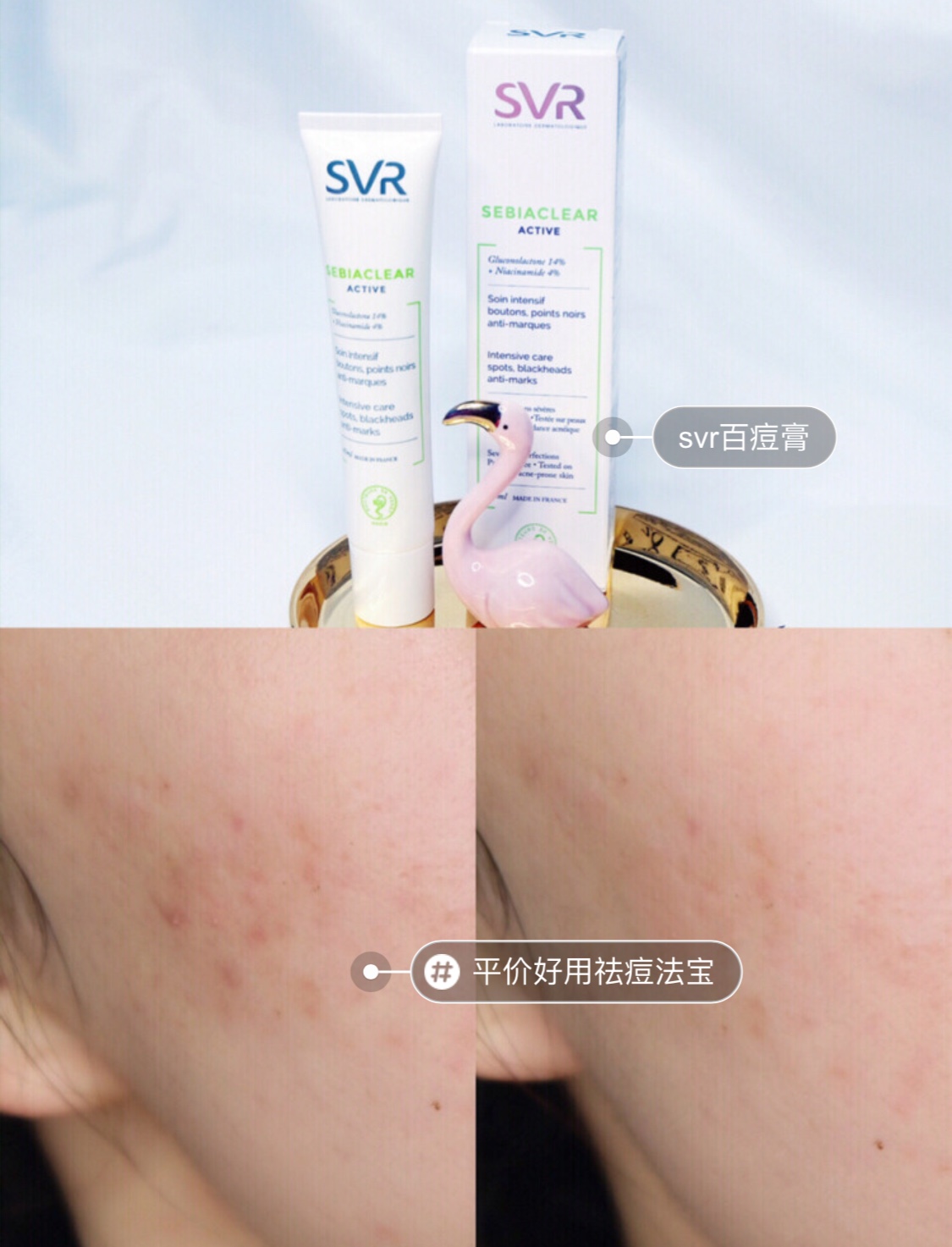 svr改善痘肌膏,svr祛痘膏测评