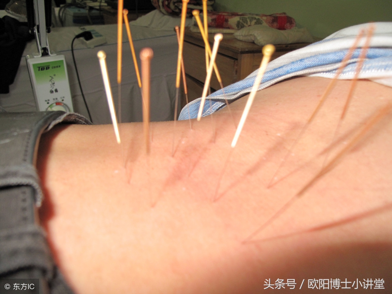 针灸为什么不能抽烟,针灸后抽烟的危害