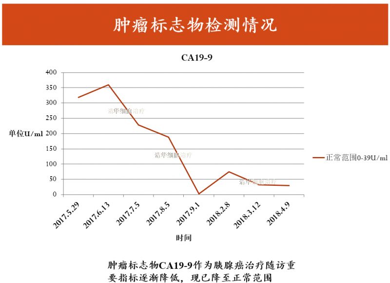 胰腺癌lla期,胰腺癌sbrt能治愈吗