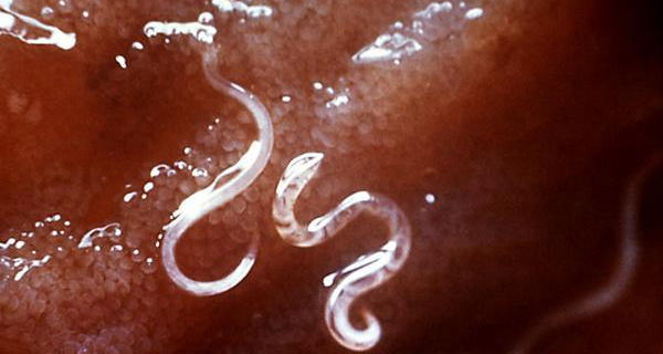 生鱼片是否有寄生虫你喜欢吃吗,生鱼片里的寄生虫能冻死吗