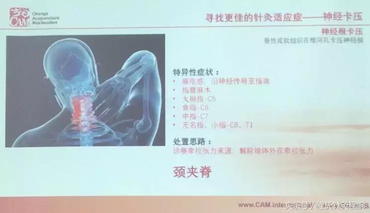 程氏针灸培训班视频,程氏针灸传承培训班怎样报名