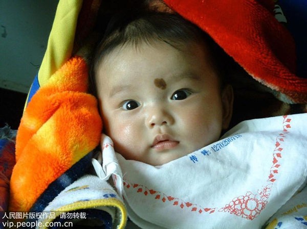 新生儿胎记有什么预兆,新生儿胎记是怎么造成的