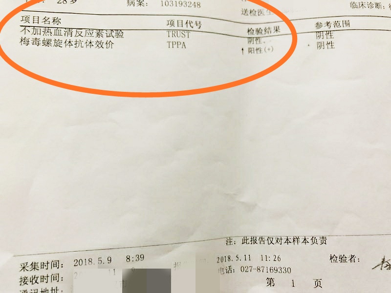 产检梅毒阴性是正常吗,孕妇产检梅毒阳性是怎么回事