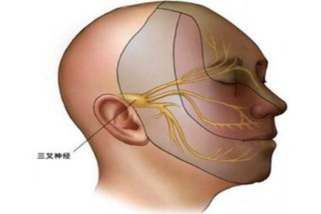 脸痛涂什么药,脸痛吃什么
