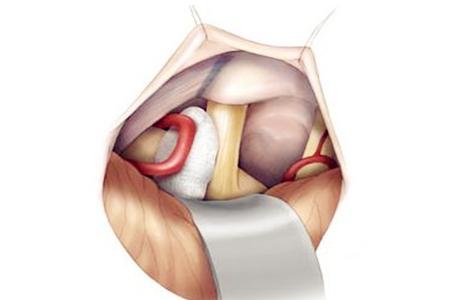 脸痛涂什么药,脸痛吃什么
