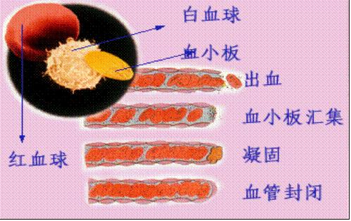 月经量多造成的失血是怎么回事,46岁月经量大血流不止