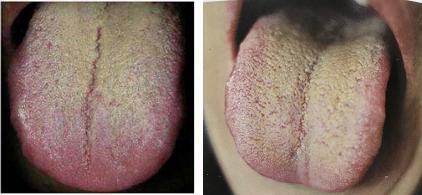 吃饭不消化肚子胀怎么回事,肚子胀不饿怎么治疗