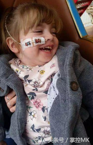 老年痴呆属于罕见病吗,罕见病孩子老年痴呆