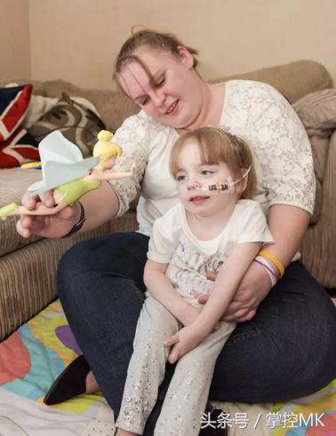 老年痴呆属于罕见病吗,罕见病孩子老年痴呆