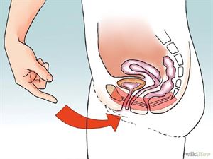 女性面对压力性尿*禁失**，该如何预防和治疗？