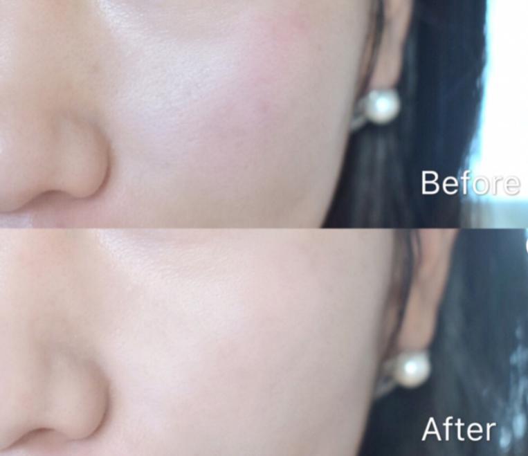 lancome兰蔻安瓶精华20ml,兰蔻安瓶精华必须一个月用完吗