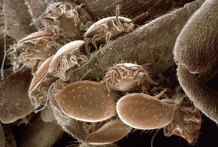 螨虫图片大全介绍,怎样去除床上的螨虫