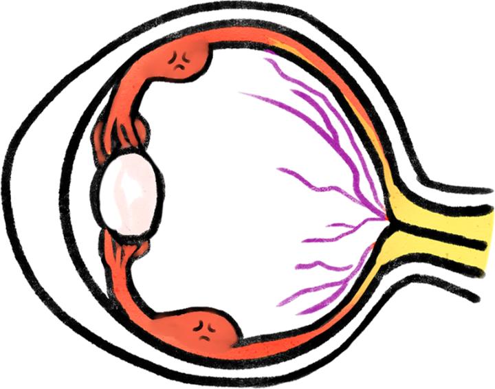 孩子怎样才能改正眯眼睛的坏习惯,小孩眯眼习惯