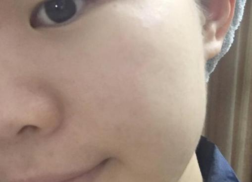 Ray面膜已经火遍世界了，各路明星都在用，别说你还没用过？