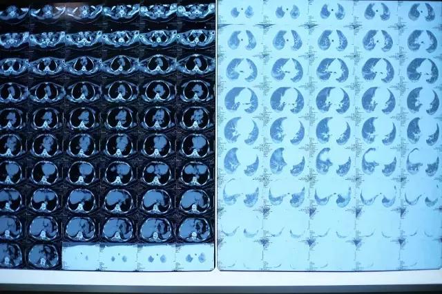 农药百草枯有救活的吗,百草枯事件给你后悔的时间