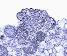 这次病毒真的会在房间传染吗,什么病毒可以传染到脑炎