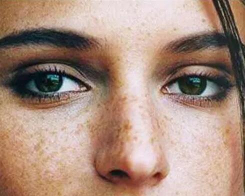 你的皮肤病，与坏情绪有关！（邯郸市丛台区中医院皮肤科）