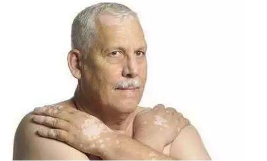 你的皮肤病，与坏情绪有关！（邯郸市丛台区中医院皮肤科）