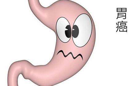 猕猴桃怎么吃能治癌症,猕猴桃一天吃几个抗癌