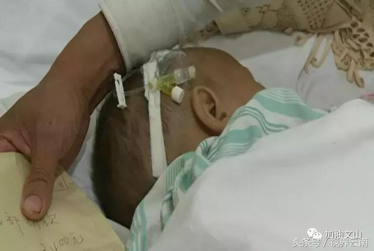 八月大孩子被亲娘挥刀割掉*体下**,文山州医院医生自发捐款出手相助