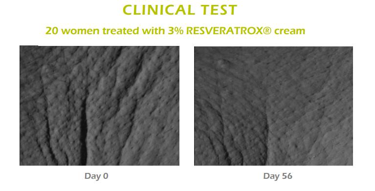 sesderma西班牙焕白果酸身体乳,西班牙美白身体乳sesderma好粘