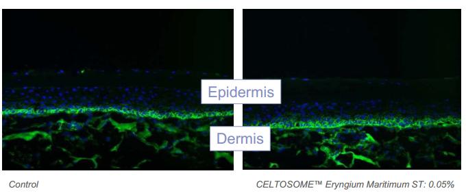 sesderma西班牙焕白果酸身体乳,西班牙美白身体乳sesderma好粘