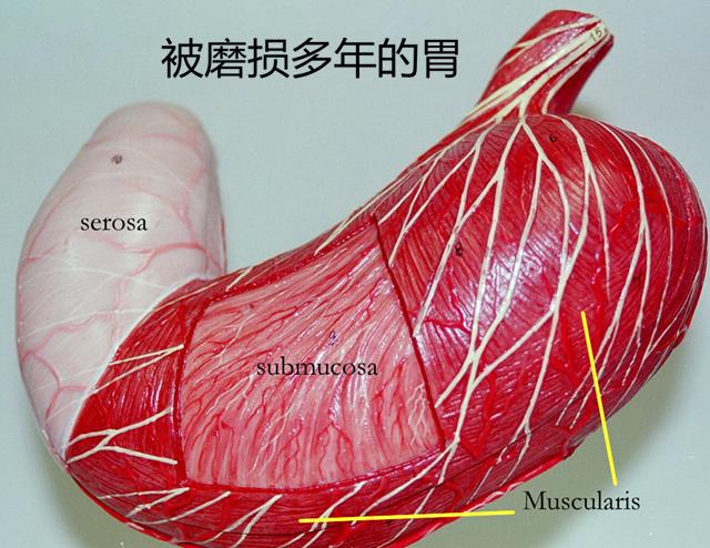 三大泻心汤的共同病机,胃阴虚可以喝甘草泻心汤