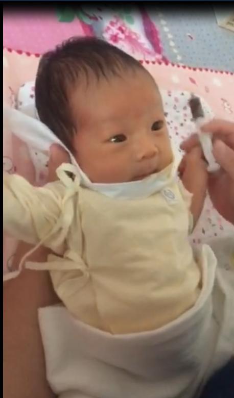 新生儿黄疸该不该处理长时间不消退该怎么办