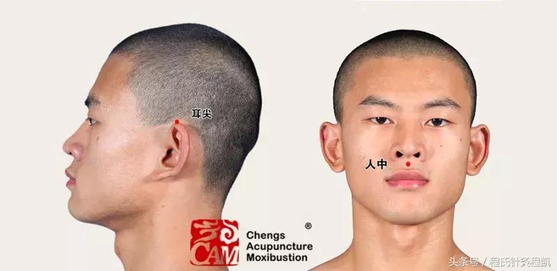 高温中暑了怎么办最快解决方法,热天中暑解救方法