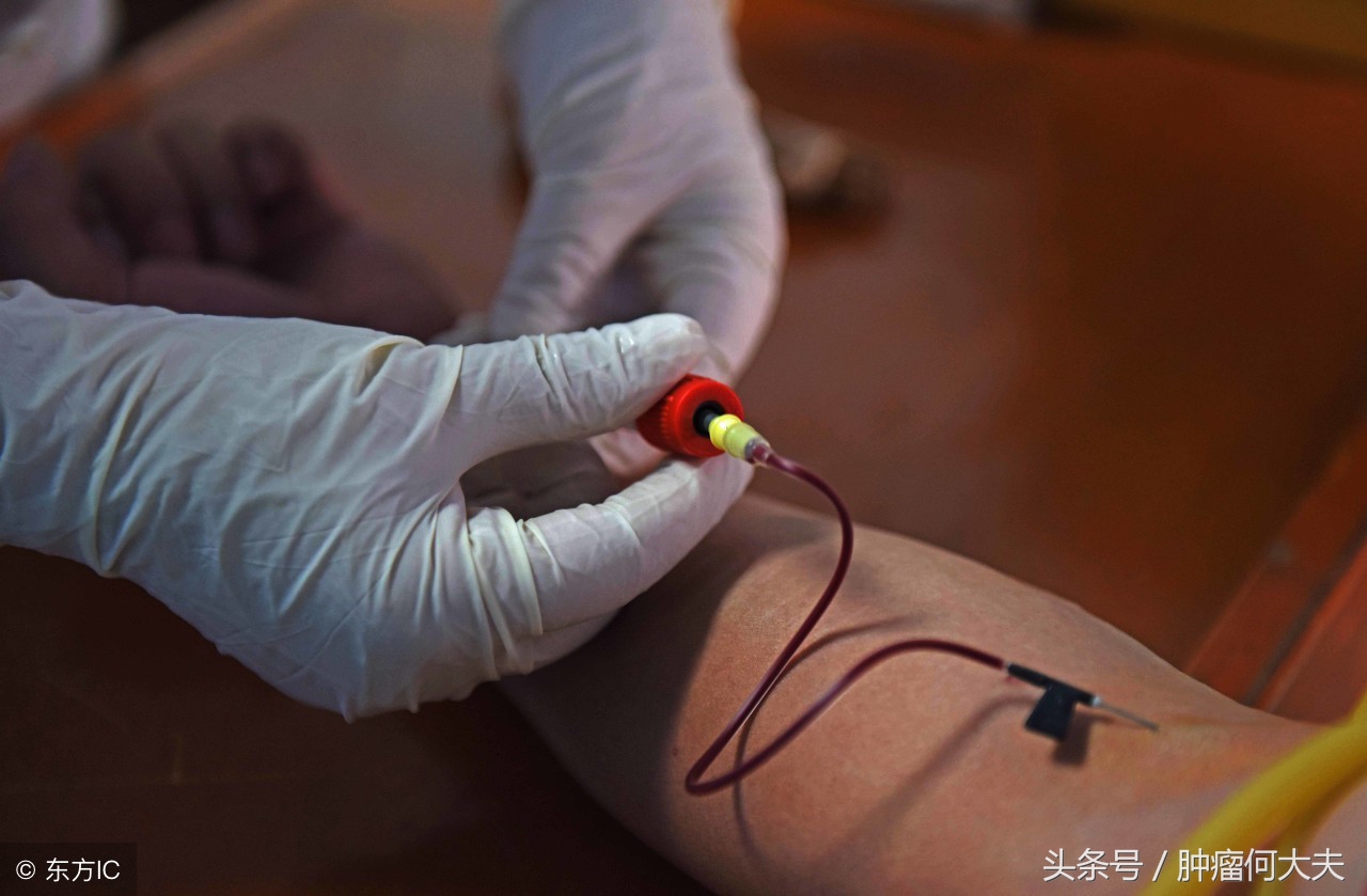 肺癌筛查最准的是用什么方法,肺癌筛查一定做肺穿刺吗