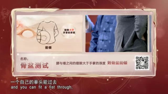 腰腿疼竟是骨盆惹的祸,骨盆前倾造成腰腿痛怎么解决