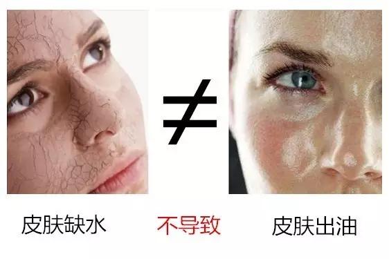 皮肤缺水外油内干怎么护肤,夏天外油内干的皮肤如何护肤