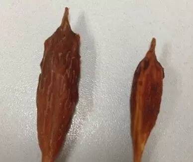 误吞了枣核咋办,误吞枣核怎么办