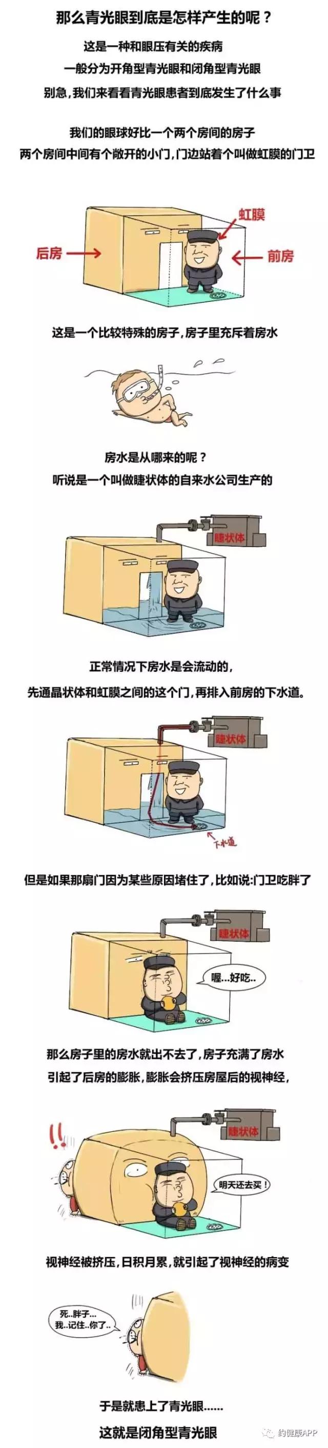 青光眼科普动画视频,青光眼动画讲解