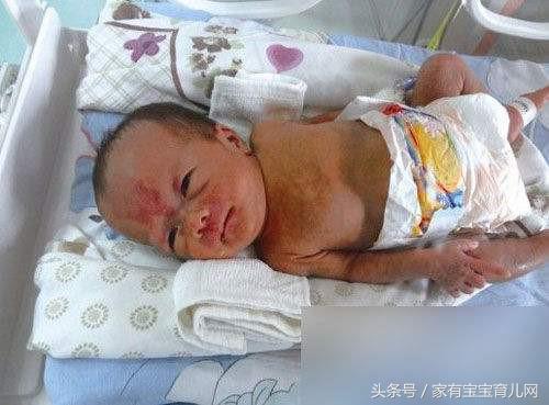 警惕！早产儿会有很多并发症的可能！如何避免？