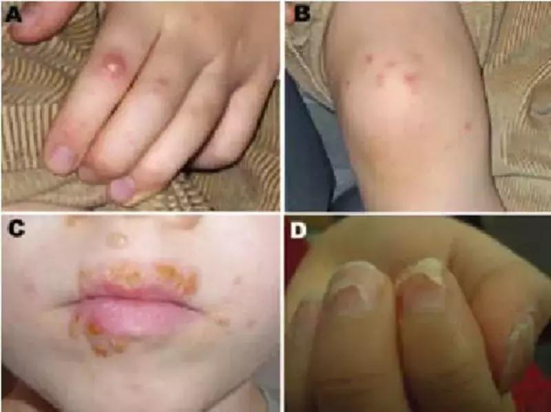 儿科门诊人满为患国家如何解决,现在儿科为什么爆满