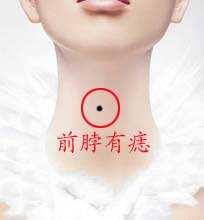 女生哪些痣是富贵痣,痣相女人脸部痣相解析