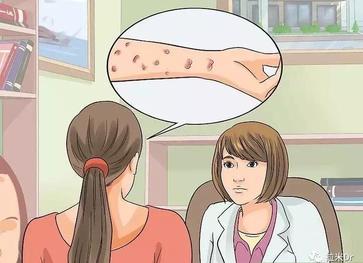 hiv药物引发的皮疹的原因,过敏性皮疹误认为是hiv