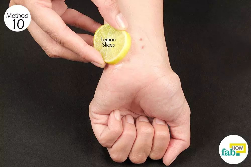 被蚊虫咬了怎么消肿止痒买什么,被蚊虫咬怎么快速消肿止痒