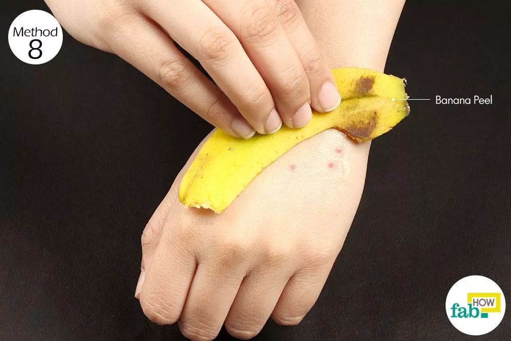 被蚊虫咬了怎么消肿止痒买什么,被蚊虫咬怎么快速消肿止痒