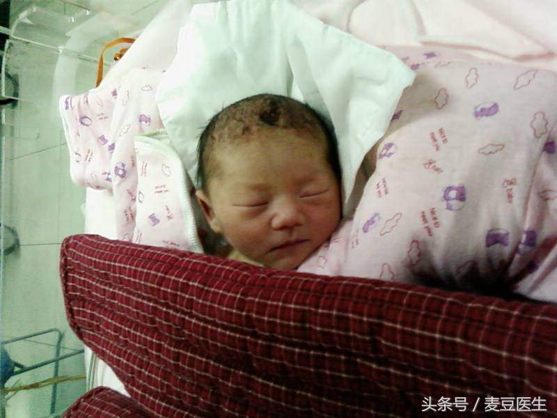 孩子嘴里手心脚上出疹，发烧是怎么回事？带你全面认识手足口病