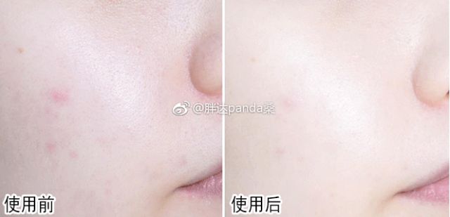 戚薇改版,戚薇变脸抖音