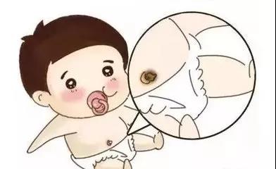 新手爸妈必看｜宝宝肚脐的奥秘