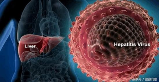 丙肝是怎样形成的它的危害大吗,丙肝好治吗丙肝的症状有哪些