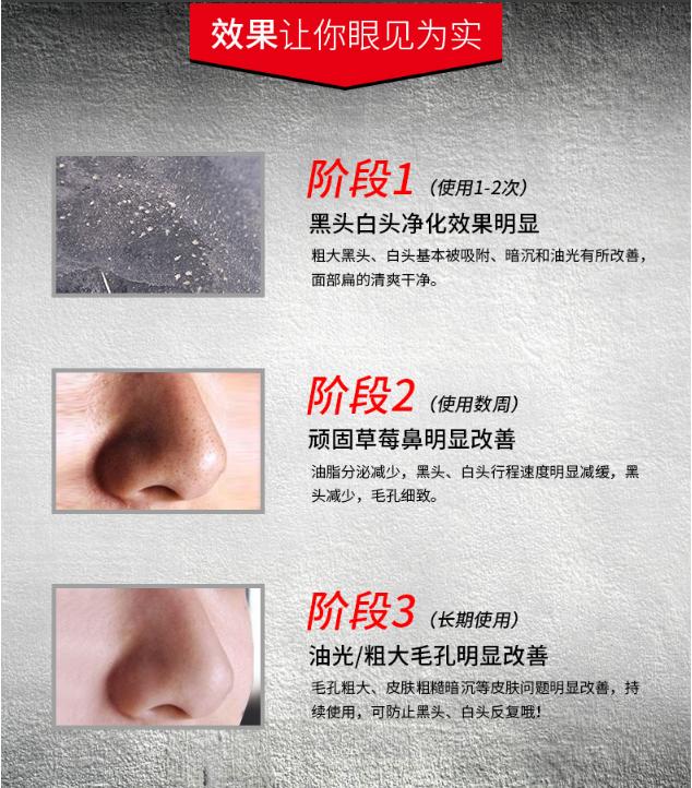男士去黑头鼻贴正确用法,如何用去黑头鼻贴