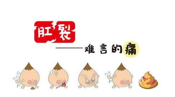 连续多天大便肛裂流血不停怎么办,每次大便肛裂怎么办