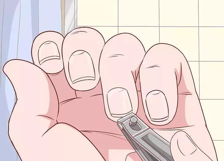 手掌发红是肝硬化的什么程度,肝硬化为何出现手掌发红