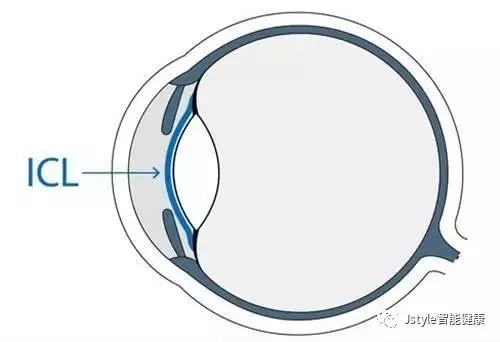 爱眼日｜最全的眼睛护理，哪些护眼方法最靠谱